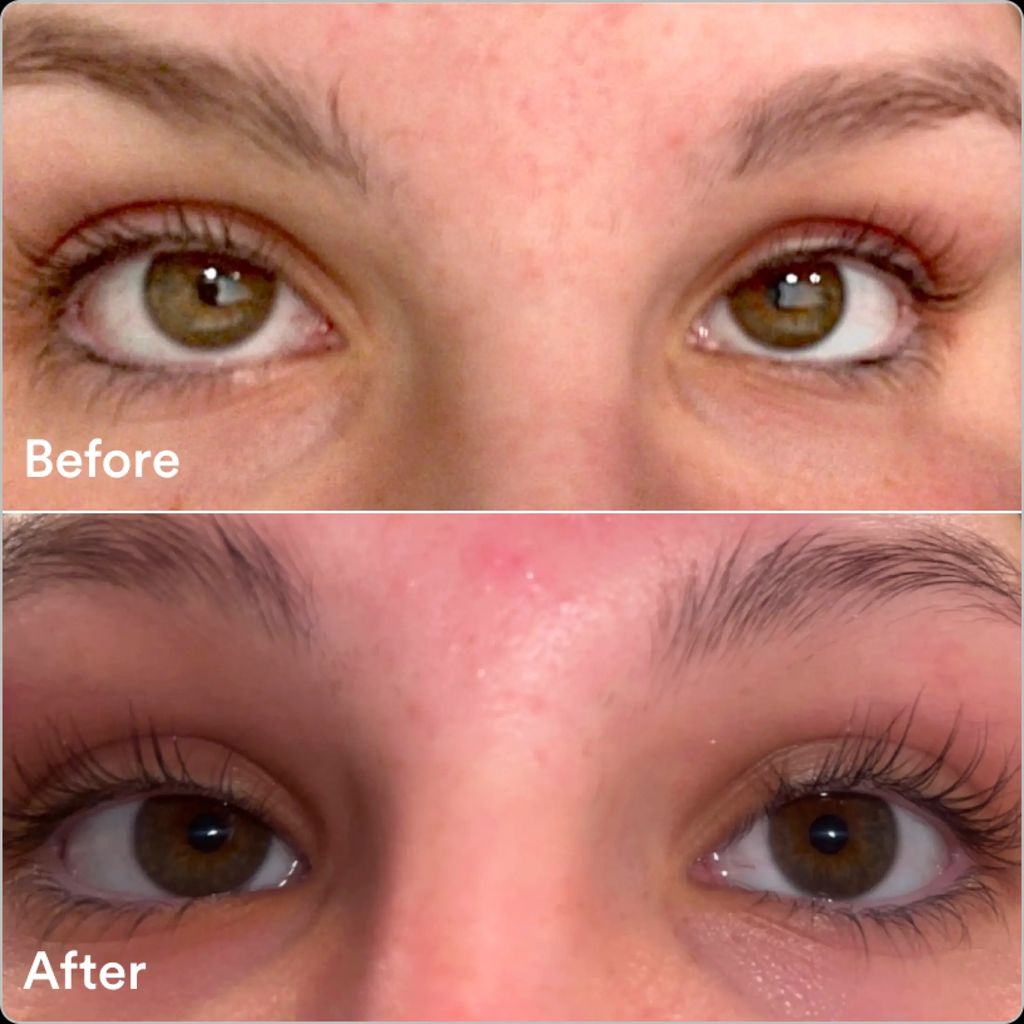 Eyelash Serum