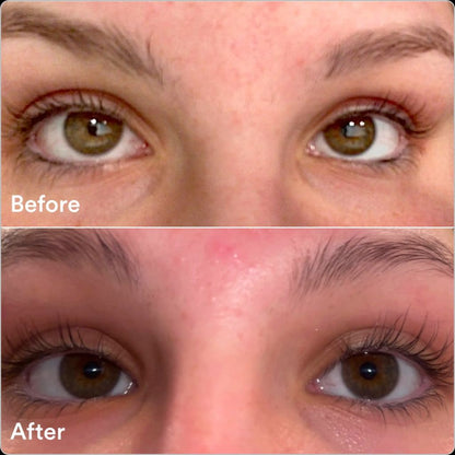 Eyelash Serum