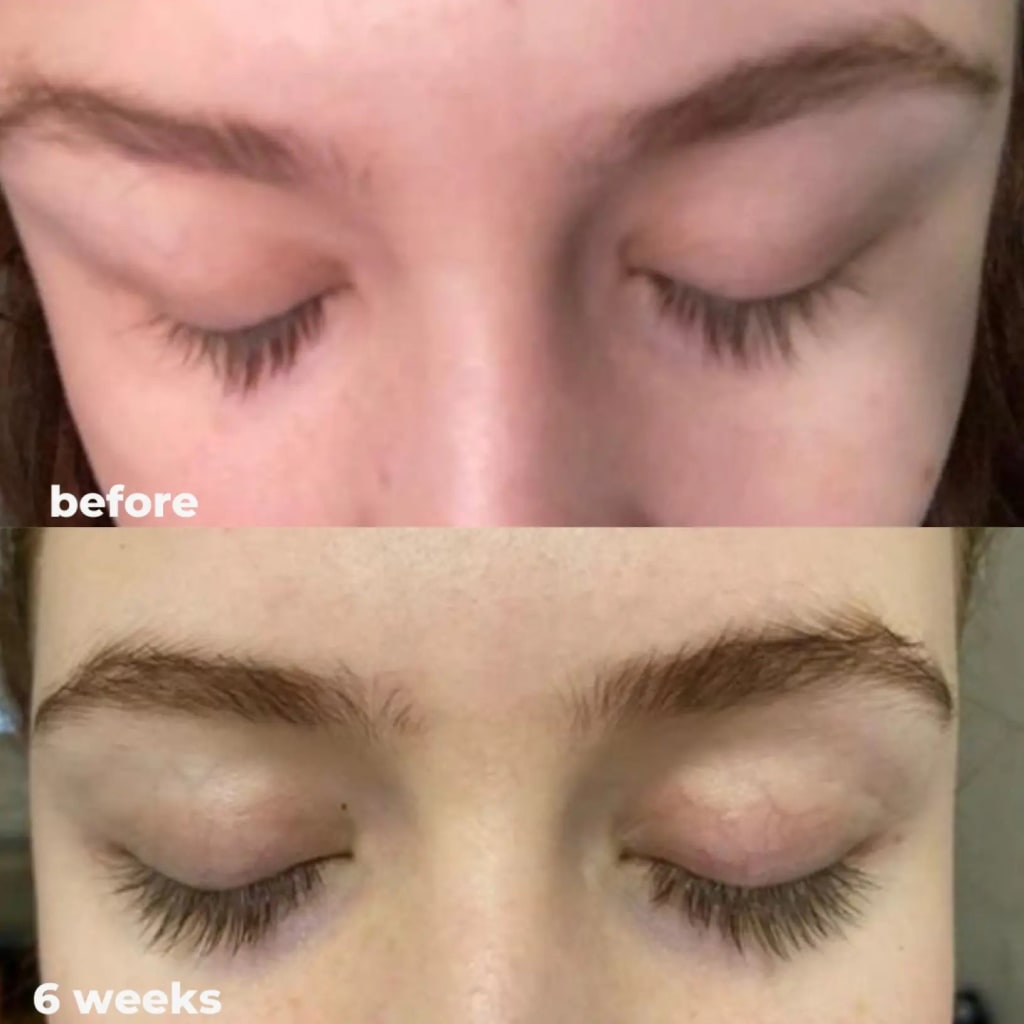 Eyelash Serum